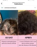 Extreme growth serum 3%