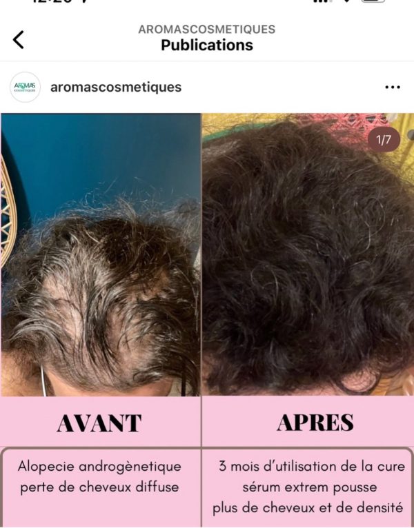 Extreme growth serum 3%