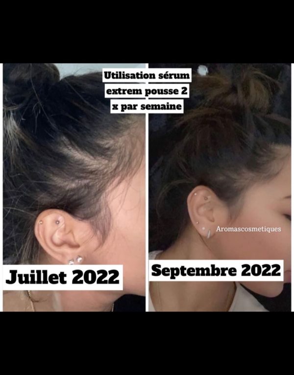 Extreme growth serum 3%