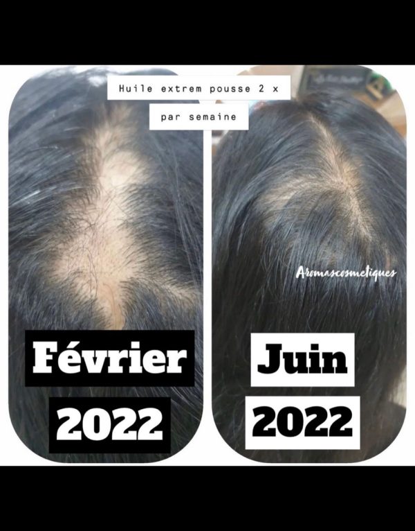 Anti-hair loss regrowth shampoo