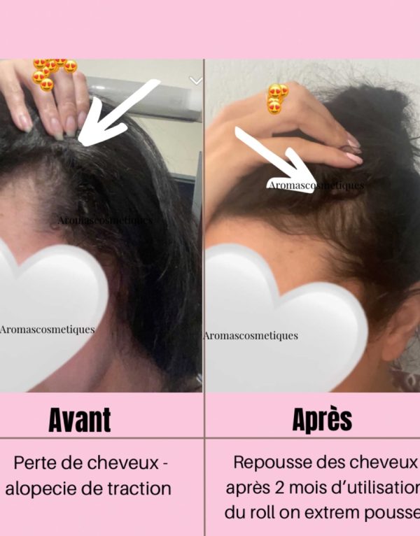 حزمة مزارع الكثافة 4 حزمة دفع الكثافة