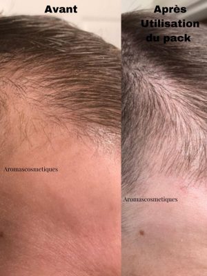 بدون عنوان (870 × 1110 بكسل) – 1